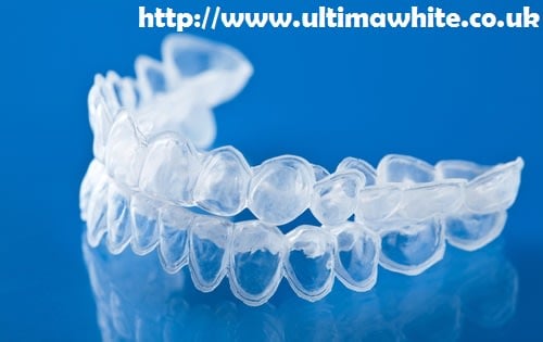 Bleaching Trays vs At-Home Laser Teeth Whitening England