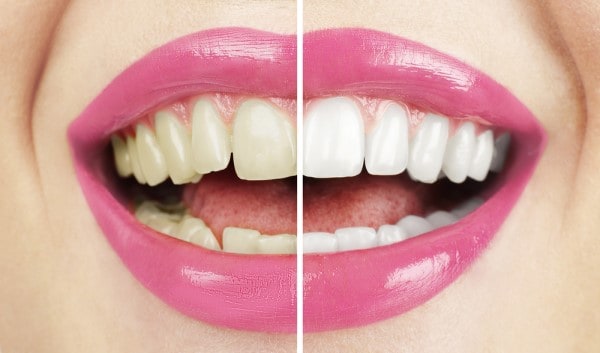 What Early Signs of Oral Cancer Should You Never Ignore England?