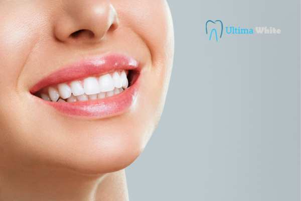 Common Mistakes That Can Ruin Your Whitening Results England
