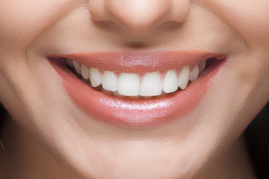The Impact of White Spots on Oral Health England