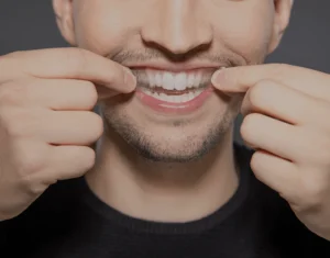Overview of Home Teeth Whitening Kits England
