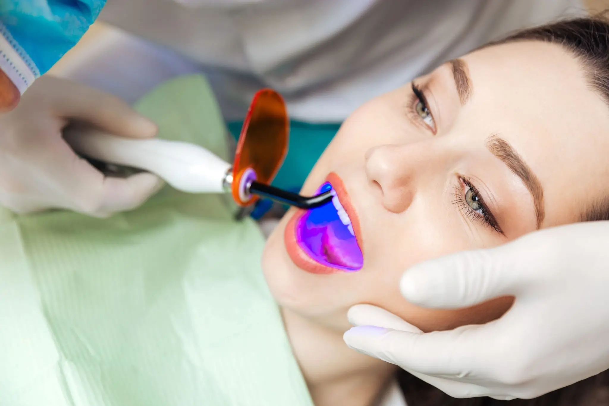 Is Laser Teeth Whitening Safe and Effective England?