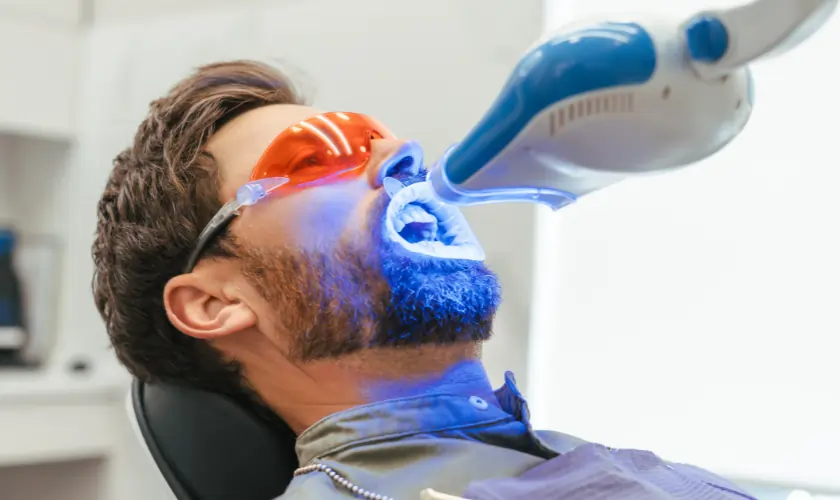 Is Laser Teeth Whitening Worth It? Pros, Cons, and Alternatives Explained England