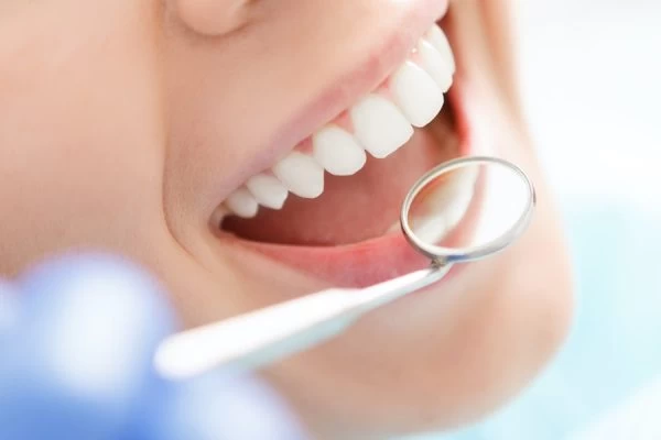 Preventing White Spots on Teeth England