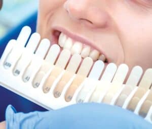 Ultimate Guide to Teeth Whitening with Natural Ingredients England