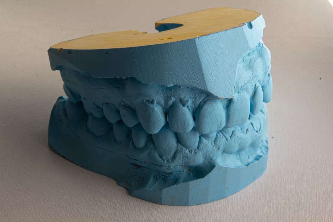 How Do Dental Implants Improve Jawbone Health and Oral Function England?