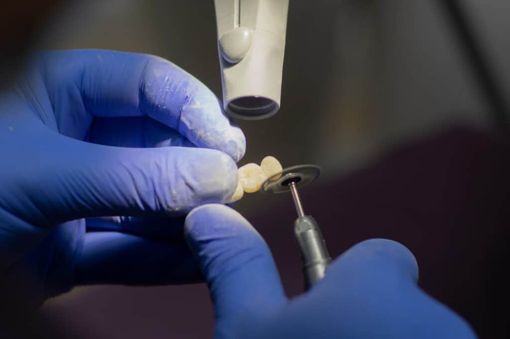 Customised Dental Solutions: Crowns, Aligners, and Implants England