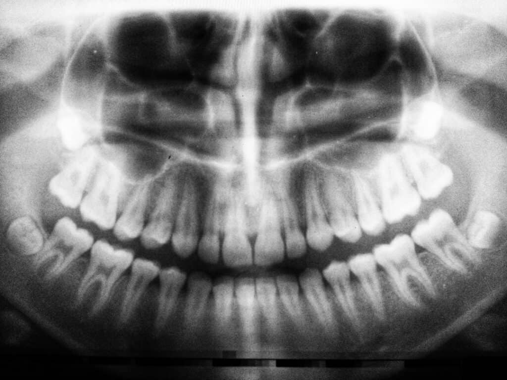 The Future of 3D Printing in Oral Healthcare England